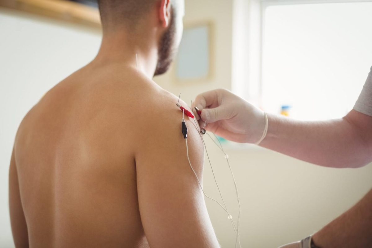 Acupunctuurbehandeling van de rug en schouders